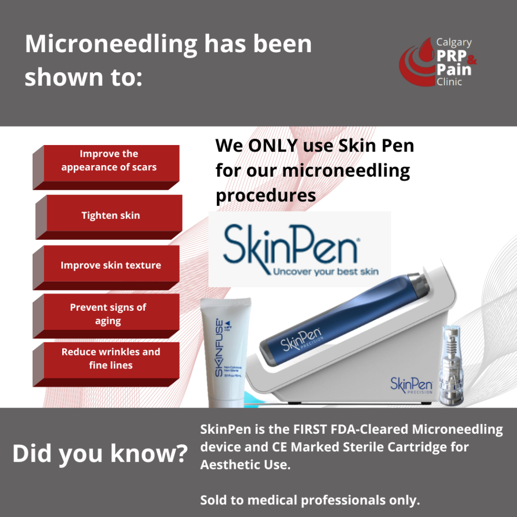 Microneedling with SkinPen