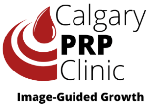 Calgary PRP Clinic